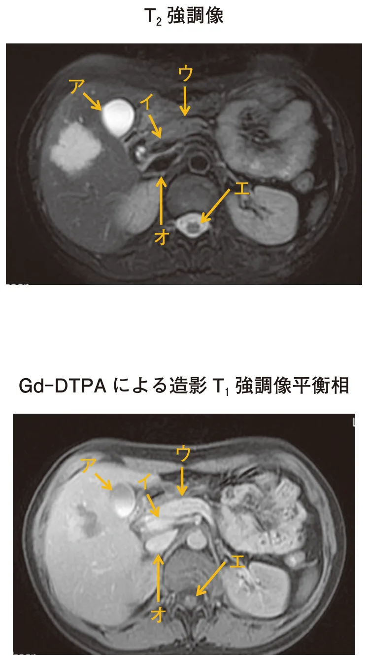 問題の図