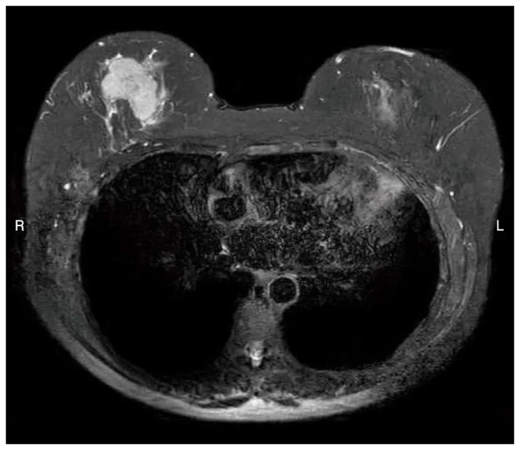 問題の図