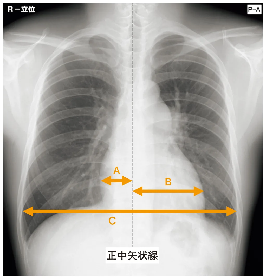 問題の図