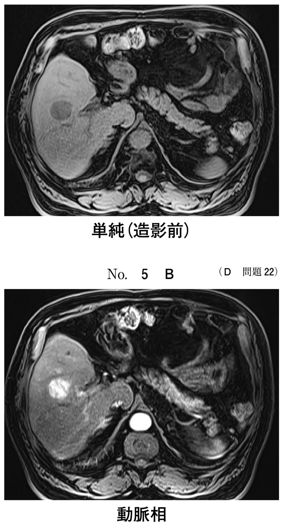 問題の図