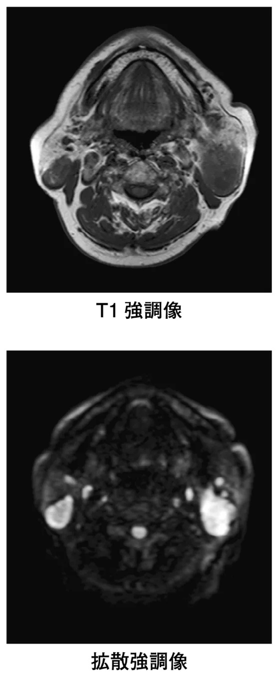 問題の図