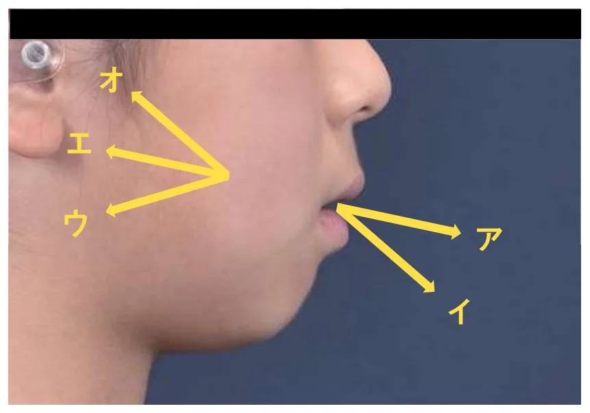 問題の図